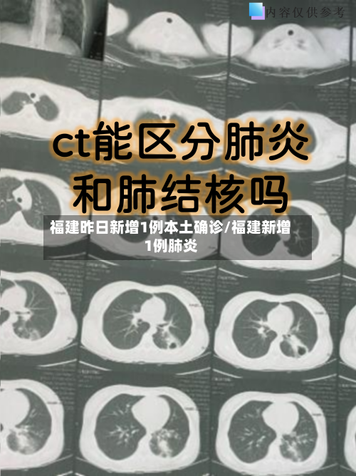 福建昨日新增1例本土确诊/福建新增1例肺炎