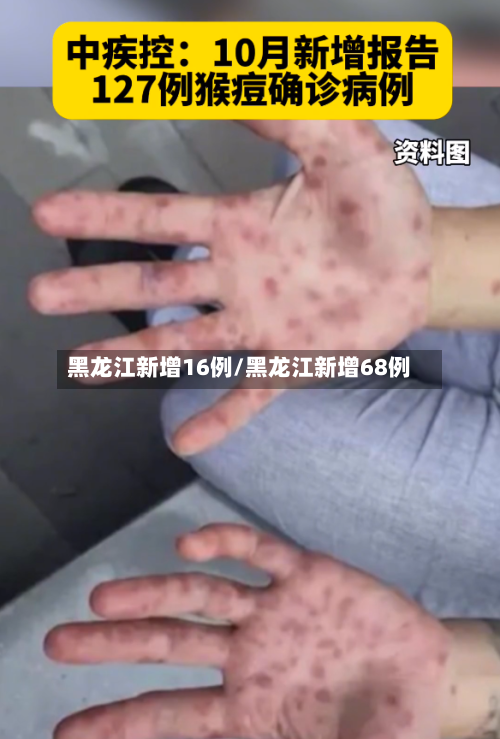 黑龙江新增16例/黑龙江新增68例-第2张图片